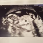 安定期に入る妊娠5ケ月まで、早産・流産防止で夫婦が守るべきこと