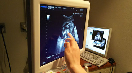 羊水検査による胎児のダウン症・染色体異常診断：妊娠15週目以降の検査